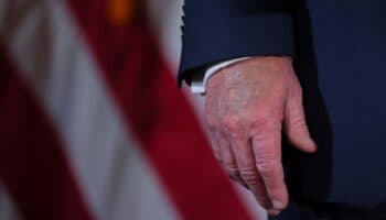 Casa Blanca confirma: Este es el problema de salud que padece Trump